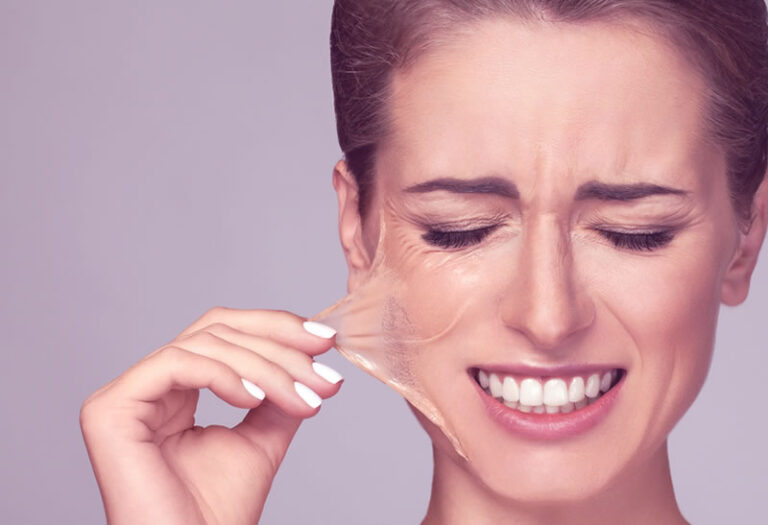 Peeling de Ácido Glicólico: Benefícios e Cuidados